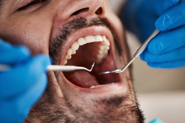 Best Pediatric Emergency Dentist in Newark, NY